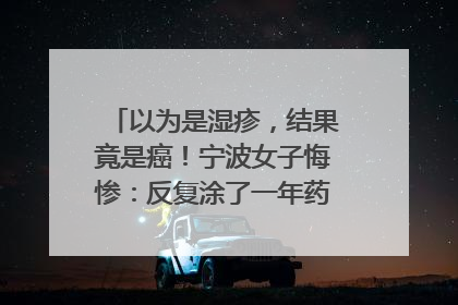 以为是湿疹，结果竟是癌！宁波女子悔惨：反复涂了一年药膏都没好！很多患者首诊都去了皮肤科